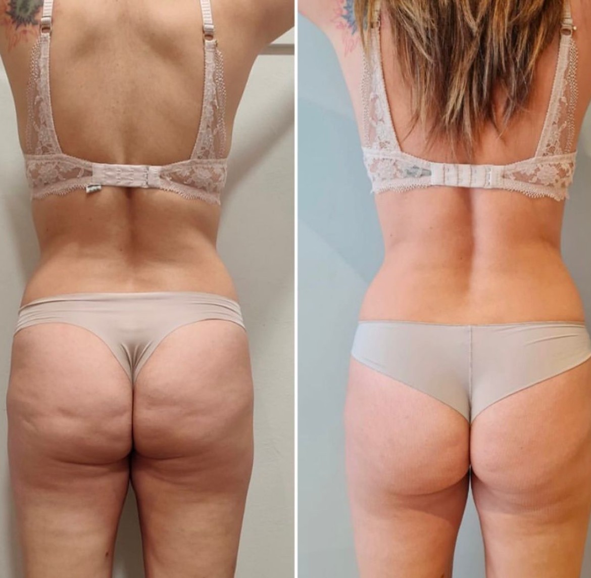 trattamenti corpo piacenza bioslimming